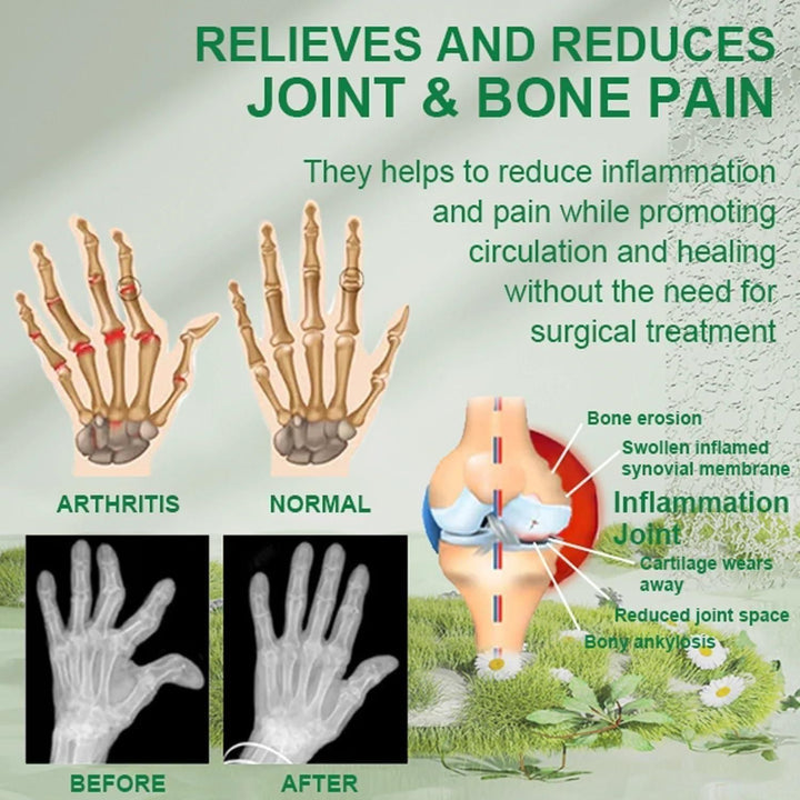 FlexiRelief Joint and Bone Therapy Cream | 🔥 BUY 1 GET 2 FREE 🔥